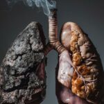 A striking image of healthy and damaged lungs symbolizing the dangers of smoking.