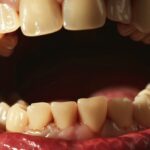 Close-up photo showcasing yellowed teeth, revealing stains, plaque buildup, and enamel erosion.